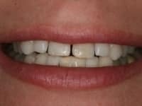Konig Center for Cosmetic & Comprehensive Dentistry smile photos
